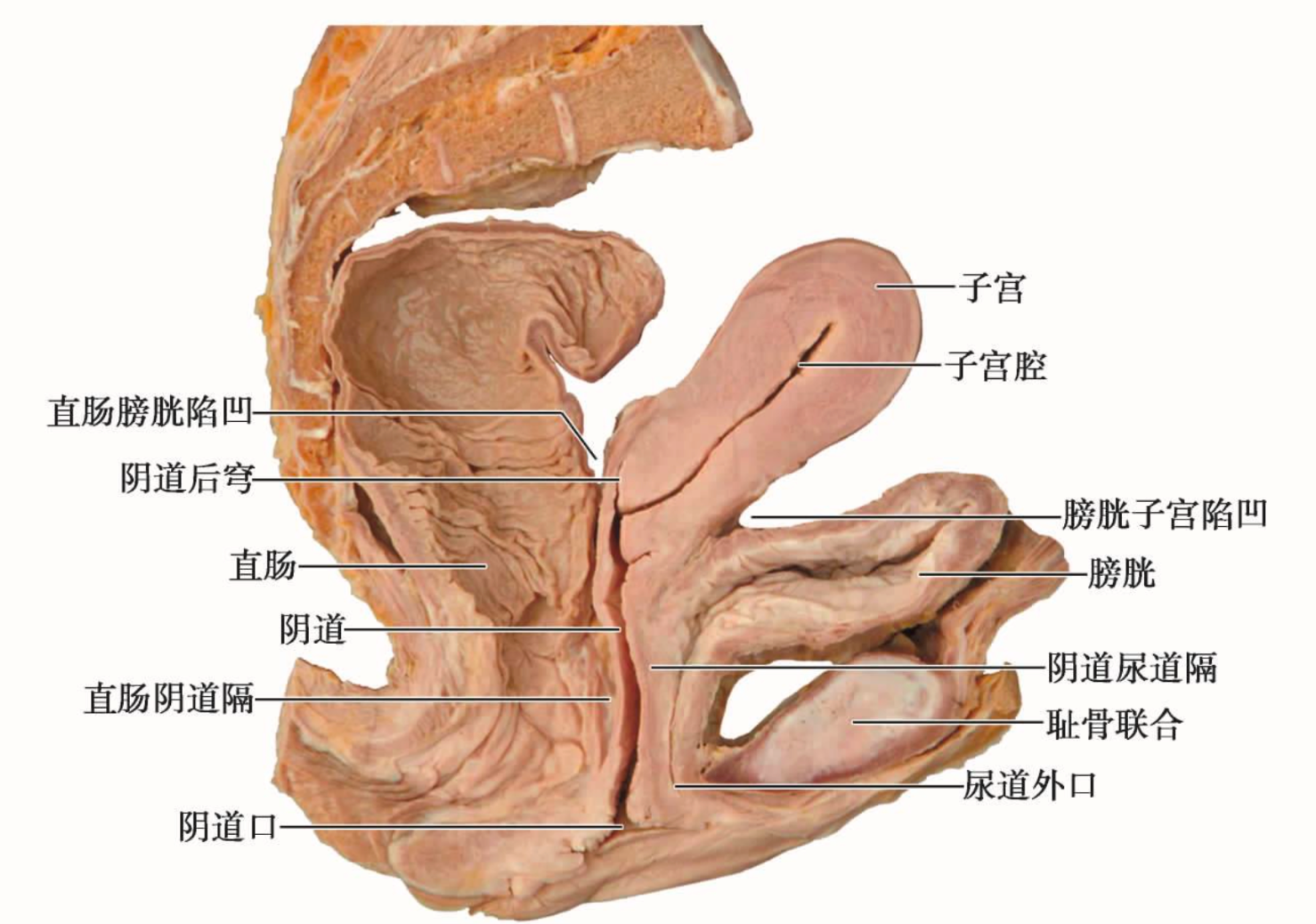 火炮——”梦无花果（0级/+2级）”评测！摸起来手感很有趣的黏膜概念杯，不过似乎并没有太多实际体验上的作用